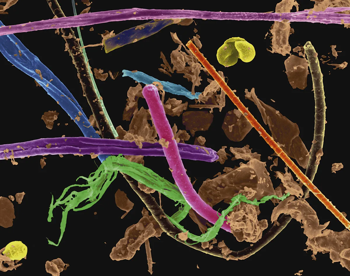This coloured microscope image of house dust contains dog hair (dark brown), cat hair (orange), plant fibres (green) and dead skin (brown) © Science Photo Library