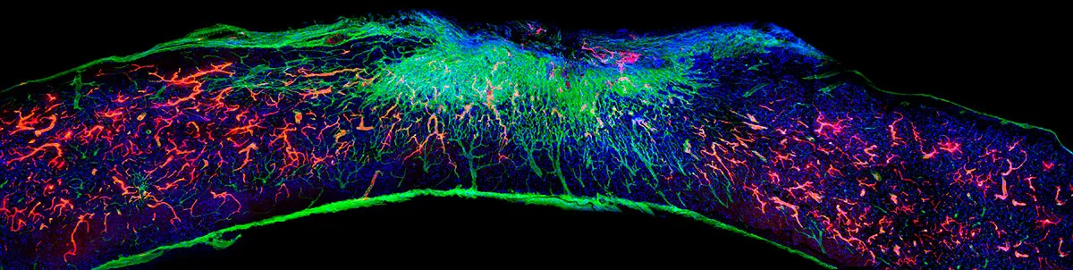 A section of damaged spinal cord treated with the therapy. The regrown blood vessels are shown in red © Samuel I. Stupp Laboratory/Northwestern University