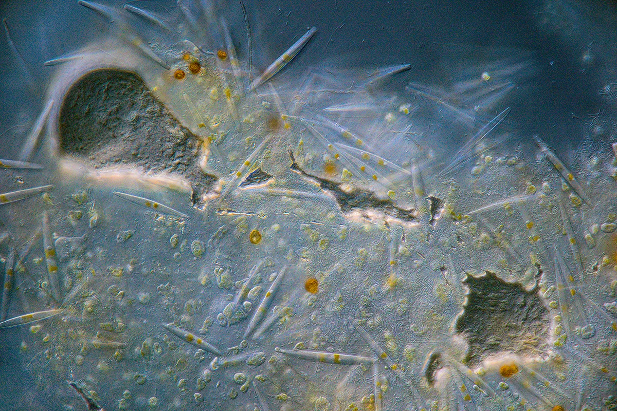 salt crystals and various micro-organism under microscope
