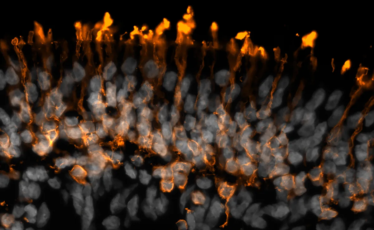 This image It shows photoreceptors, which when stained generated an orange flame, grown in the lab from stem cells. Photoreceptors are the cells in the retina, a thin layer of tissue in the back of our eye, that help us to detect light and ultimately see. Retinal degenerative disorders are the leading cause of blindness worldwide with debilitating life-long consequences for those affected. It is hoped that one day we may be able to transfer cells like these, grown in a lab, into patients to help restore their sight. Photo by Dr Hassan Rashidi
