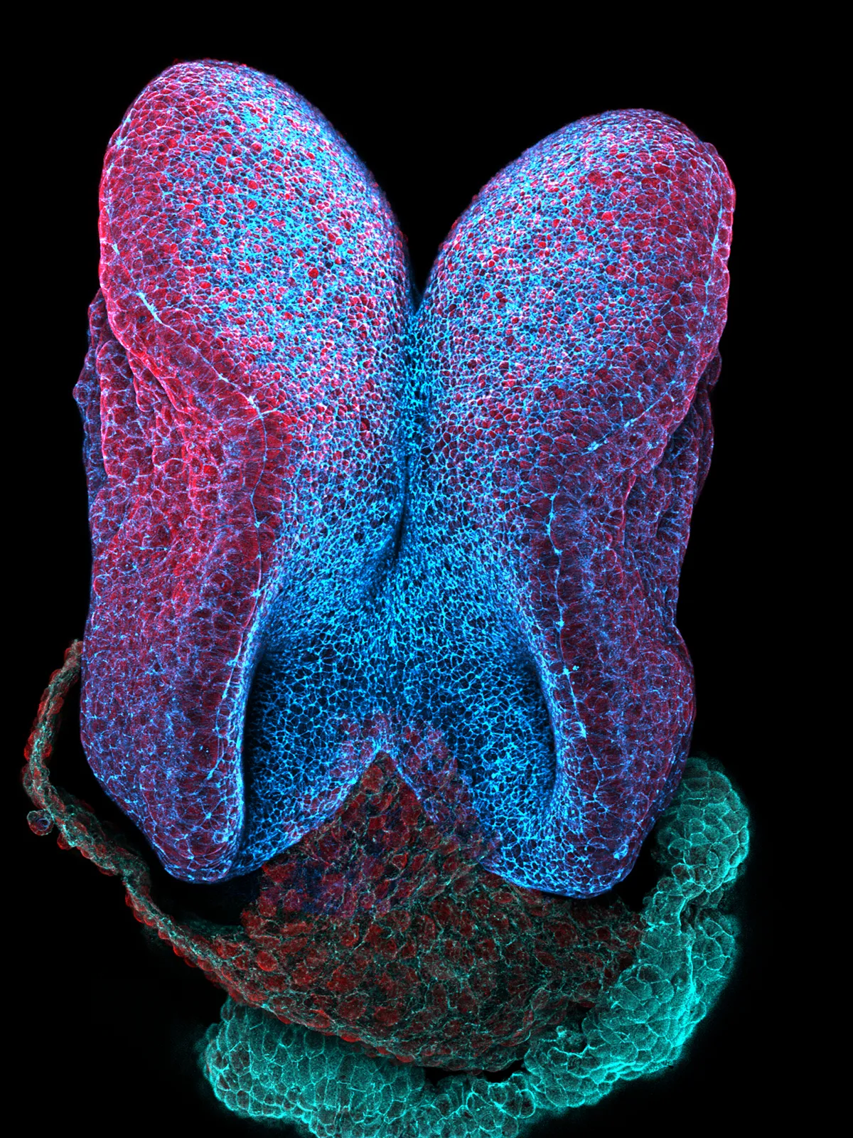 'Split brain' was entered by Dr Gabriel Galea, Wellcome Clinical Research Career Development Fellow at UCL GOS ICH. This image shows the very early development of a mouse embryo brain. At this stage when the embryo is just two millimetres long, the brain is split down the middle, each side developing independently. The left and right halves can be seen gradually folding to meet each other, like two butterfly wings coming up to meet at the tips. Eventually these folds meet in the middle, fusing into a single brain. In around 1 in every 1,000 pregnancies either the brain or spinal cord fail to close together. Failure to fully close the brain causes a deadly malformation known as anencephaly. Gabriel's team are trying to understand what causes anencephaly and how we may prevent it by studying the closing process in their lab.
