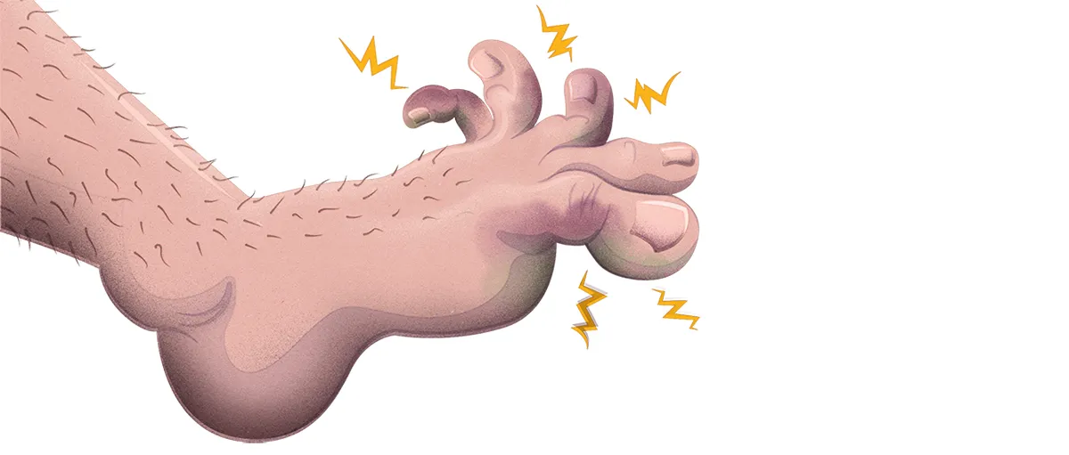 How do I know if my toe is broken or just bruised? - BBC Science Focus ...