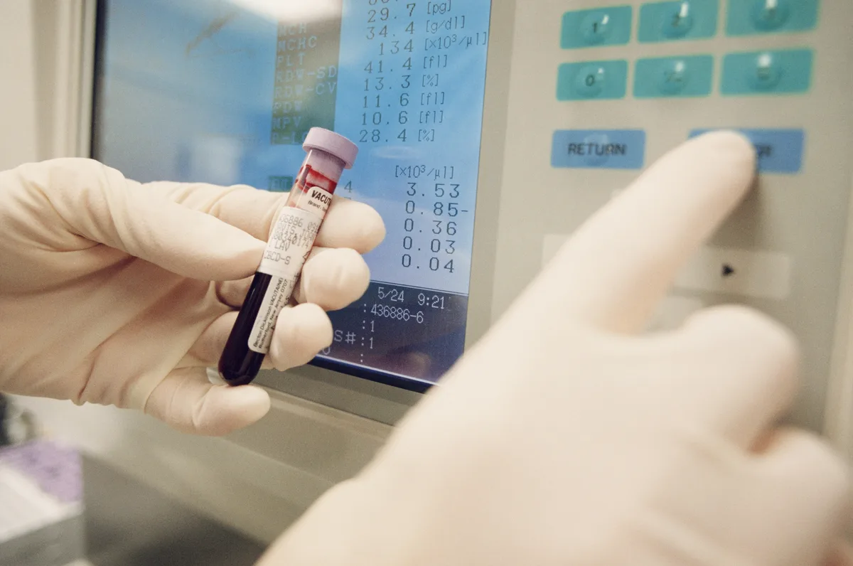 Ground-breaking test can catch signs of 14 early-stage cancers - BBC ...