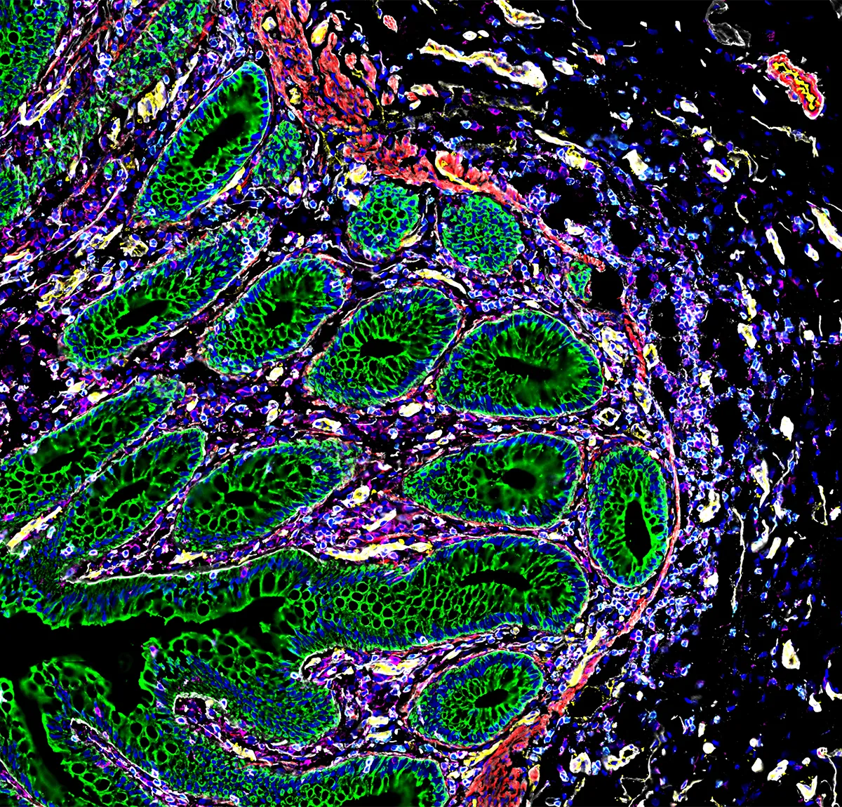 green areas of stomach microscope image