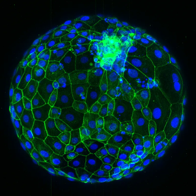 Microscopy image of a human embryo 7 days after fertilisation. Nuclei are shown in blue, and the shape of each cell is outlined in green. Some scientists would like to extend the limit on embryo research beyond 14 days.