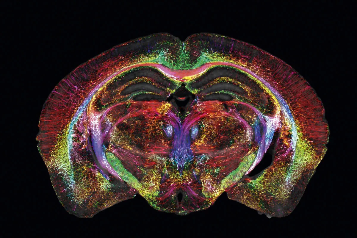 Multicoloured map of the human brain