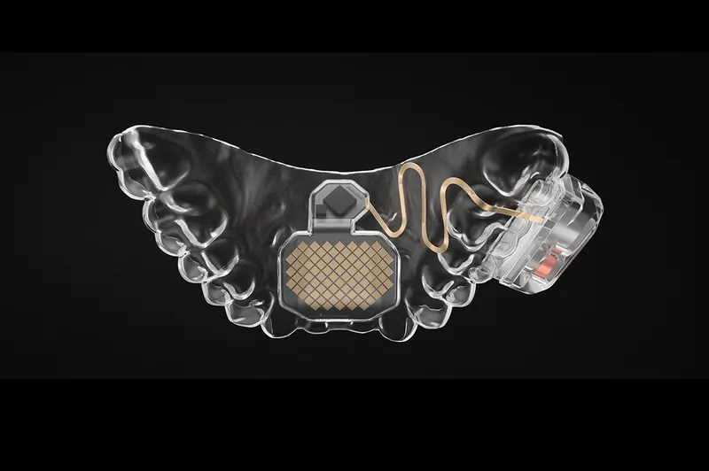 The MouthPad sits on a black background. It resembles a cast of someones teeth with a pad on the top