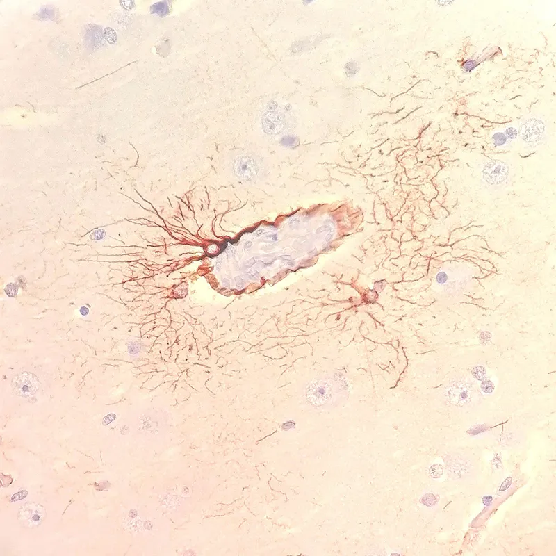 Small cell with tails under microscope