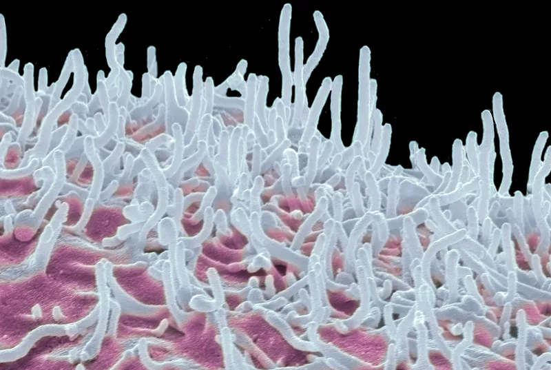 Close up of cancer cells in an illustration