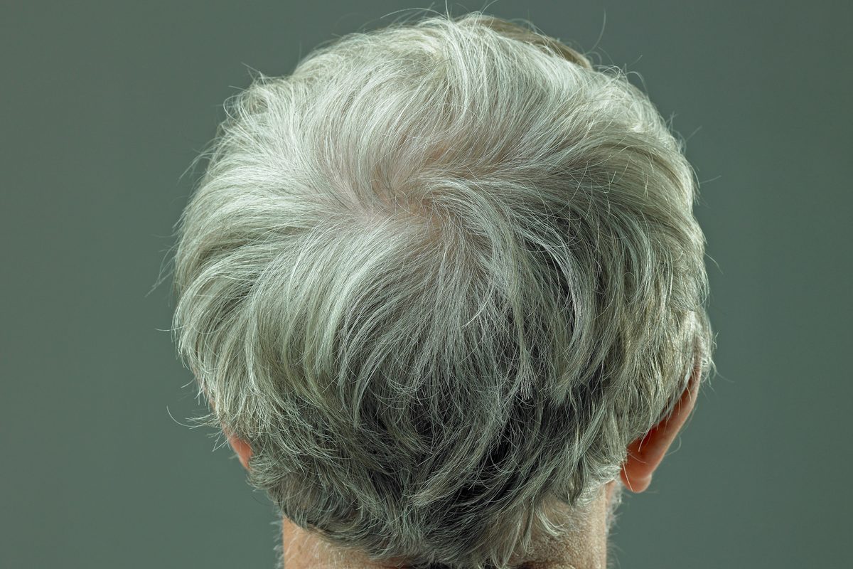 Wir haben möglicherweise endlich einen Weg gefunden, graue Haare ...