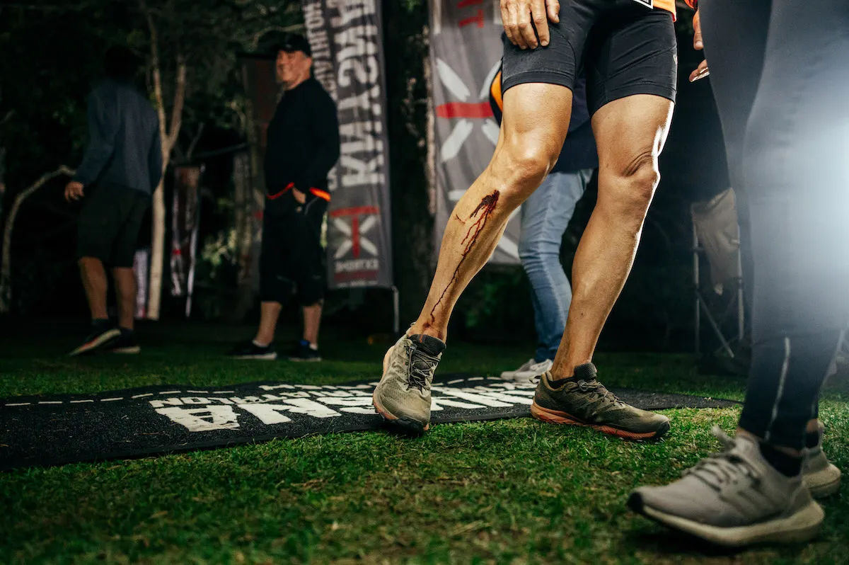 Close up of an athlete's leg bleeding as he crosses the finish line of the 2023 Knysna XTri