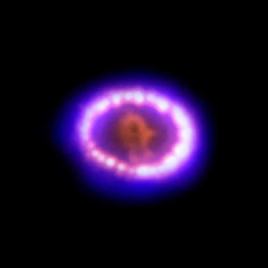 Chandra X-ray Observatory image of Supernova 1987 A