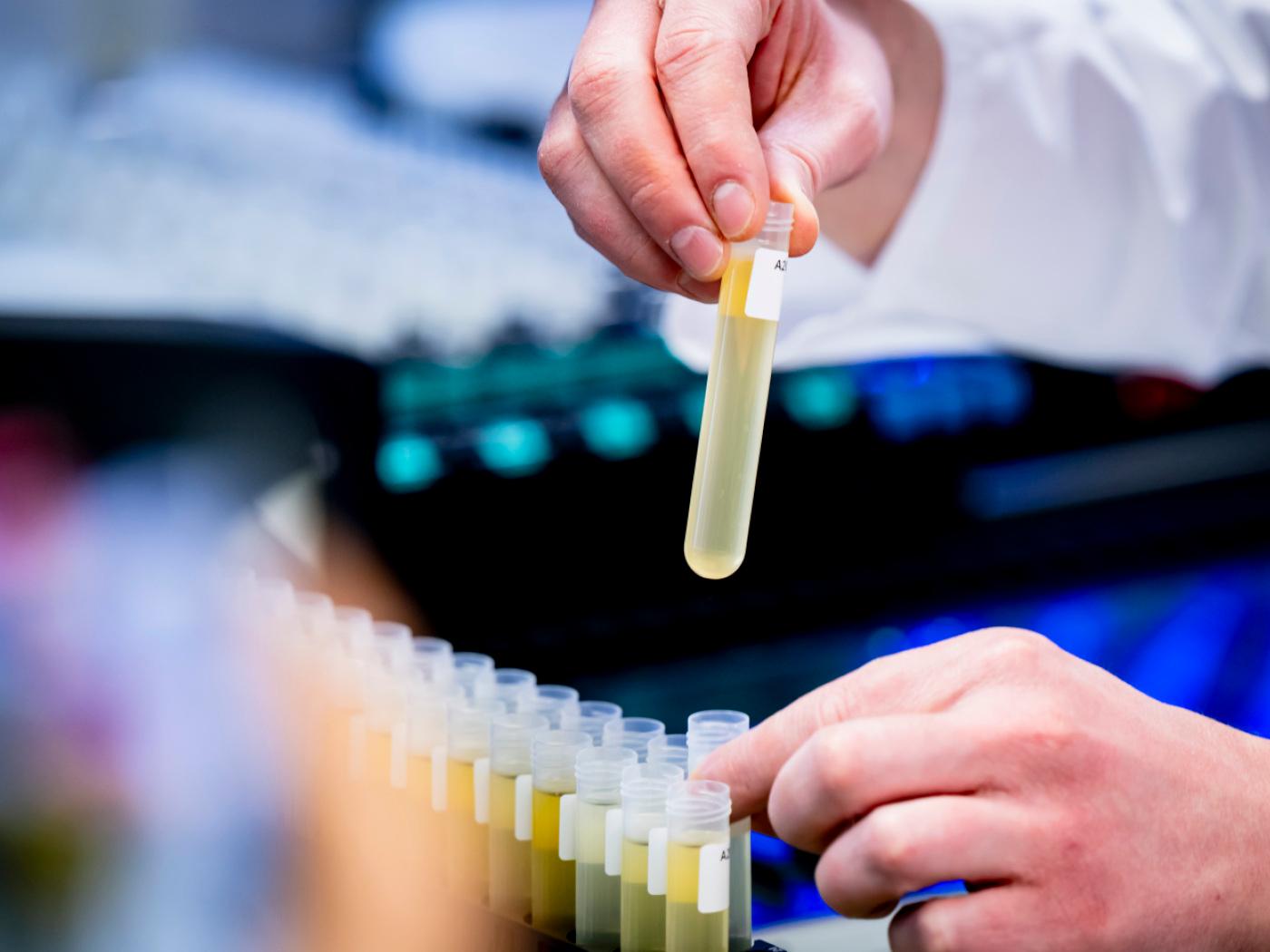 Die Polizei hat in Pratteln BL 3200 Injektionsflaschen mit illegal importierten Peptiden gefunden. Wer solche Produkte im Sport anwendet, riskiert einen Verstoss gegen Anti-Doping-Bestimmungen. (Symbolbild)