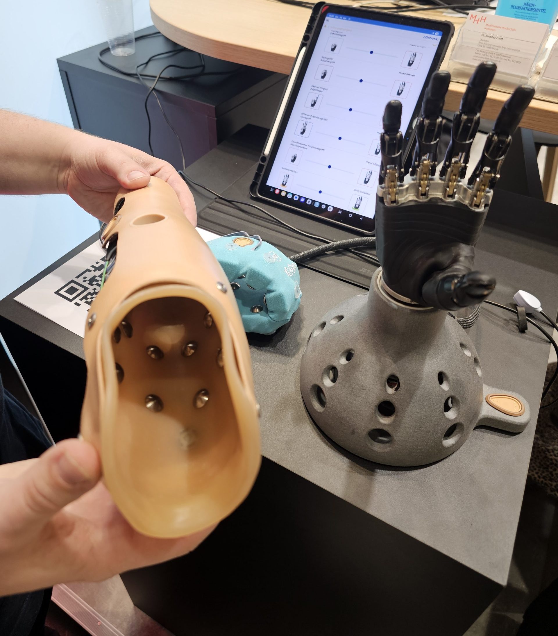 Armprothese mit Sensoren steuert Hand